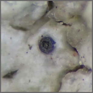 Sclerococcum parasiticum