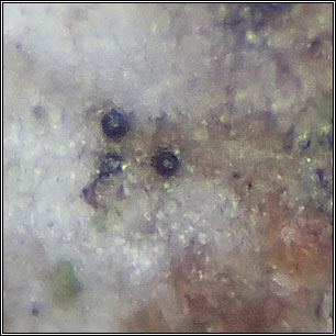 Q on Arthonia radiata