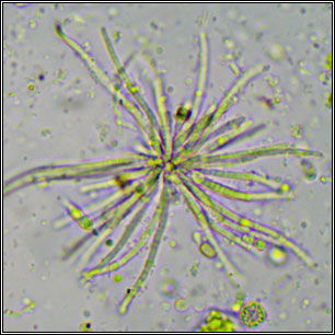 Psammina filamentosa