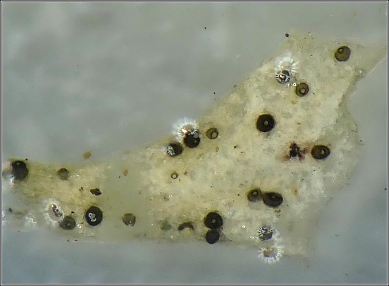 Abrothallus suecicus (anamorph)