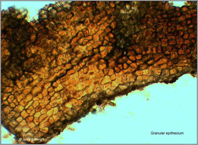 Teloschistes chrysophthalmus, epithecium