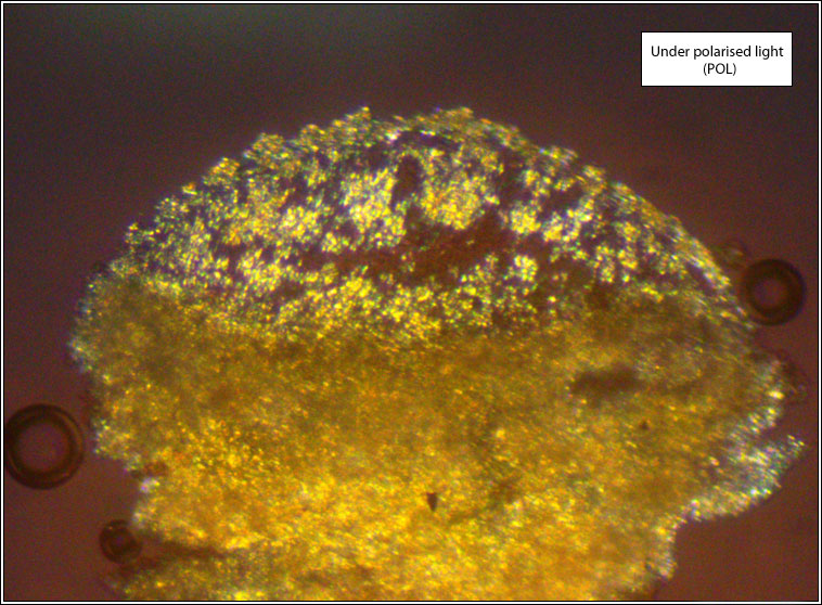 Lecanora albella, under polarised light (POL)