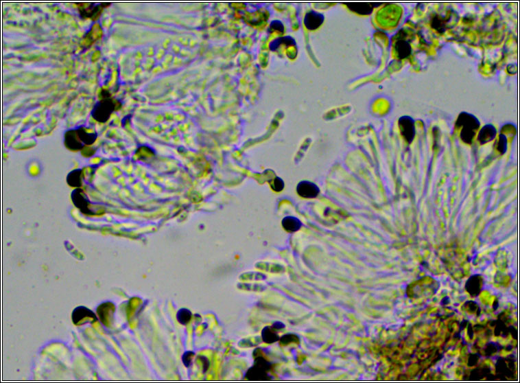 Catillaria nigroclavata