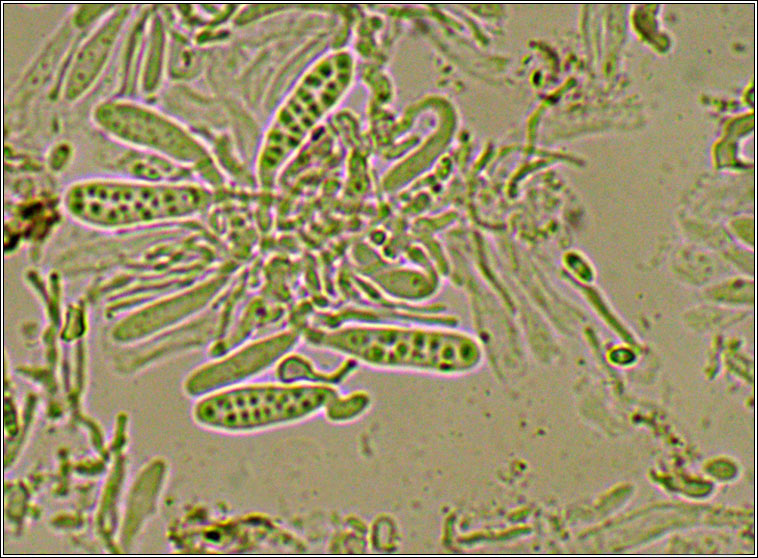Unguiculariopsis thallophila