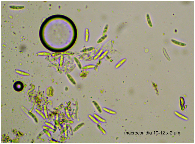 Anisomeridium viridescens