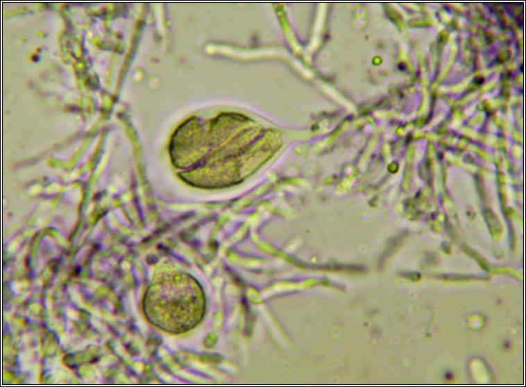 Tremella pertusariae