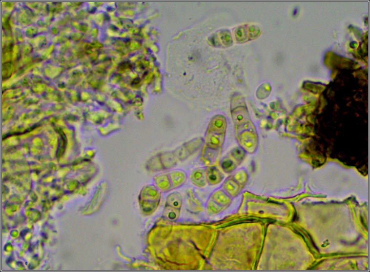 Tomasellia gelatinosa