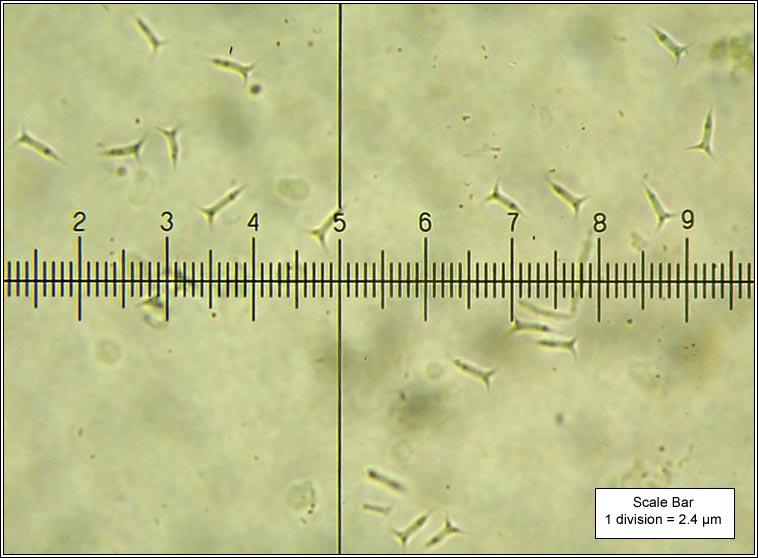 Spirographa lichenicola