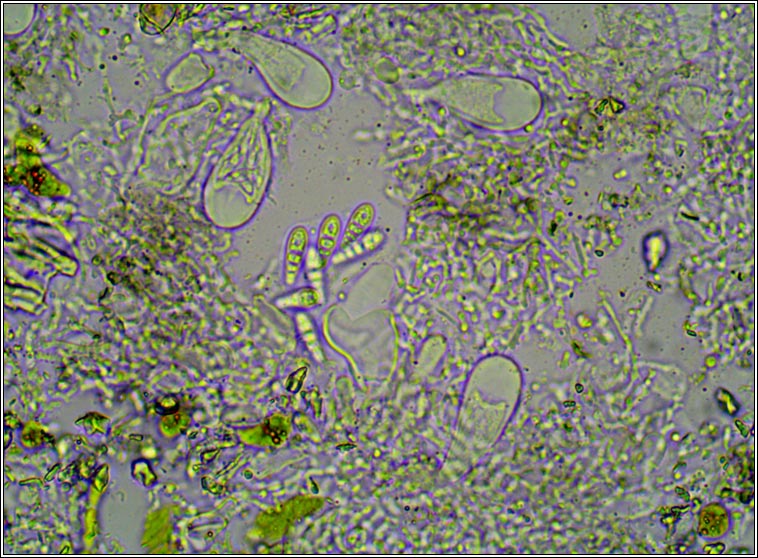 Arthonia phaeographidicola